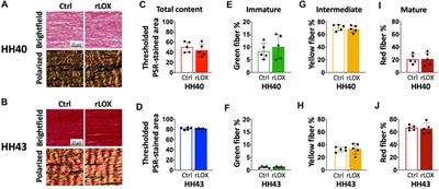 Tendon mechanical properties are enhanced via recombinant lysyl oxidase treatment